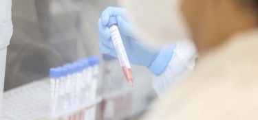 Paraná é o segundo estado com o menor número de casos e óbitos de Covid-19 Paraná é o segundo estado com o menor número de casos e óbitos de Covid-19
